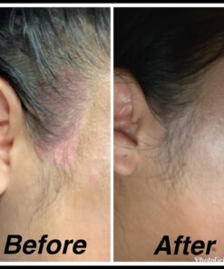 MG217 Psoriasis Treatment, Medicated Conditioning 2% Coal Tar Multi-Symptom Ointment, 3.8 Ounce Discontinued 3.8 Ounce 19 71swmZSVZqL