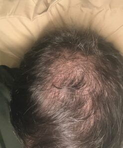 Volumizing Biotin Shampoo for Thinning Hair - Thin Hair Shampoo with Rosemary Argan and Essential Oils for Hair Care - Vegan Sulfate Free Shampoo for Damaged Dry Hair Paraben and Cruelty Free Sandalwood 16 Fl Oz (Pack of 1) 46 71t423v5nfL