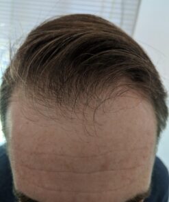 Volumizing Biotin Shampoo for Thinning Hair - Thin Hair Shampoo with Rosemary Argan and Essential Oils for Hair Care - Vegan Sulfate Free Shampoo for Damaged Dry Hair Paraben and Cruelty Free Sandalwood 16 Fl Oz (Pack of 1) 50 71tNBHYlduL