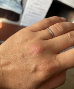 Compound W Maximum Strength Fast Acting Gel Wart Remover, 0.25 oz, 2 Pack unflavored 0.5 Ounce (Pack of 1) 48 71tV4rlhJhL