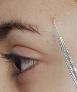 Suvorna Skinpal Pimple Popper Tool Kit | Milia Remover | Lancets for Facial Extraction | Whitehead Extractor Tool | Comedone Extractor | Blackhead Remover Tool | Acne Needle Tool & Cyst Removal Tool. 30 71u4ow6F2L 2