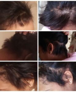 Natrol Biotin Beauty Tablets, Promotes Healthy Hair, Skin and Nails, Helps Support Energy Metabolism, Helps Convert Food Into Energy, Maximum Strength, 10,000mcg, 100 Count (Pack of 1) 100 Count (Pack of 1) 41 71uOOHrGjVL