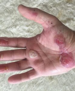 Structured Colloidal Silver Gel for Burns and Wounds - Cooling Silver Extra Strength 35ppm Silver Gel 37 71uQz4rDRL