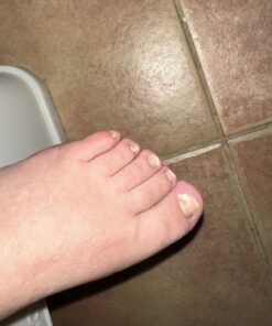 Kerasal Nail Renewal, Restores Appearance of Discolored or Damaged Nails, 0.33 fl oz (Packaging May Vary) 31 71uikZmpUL