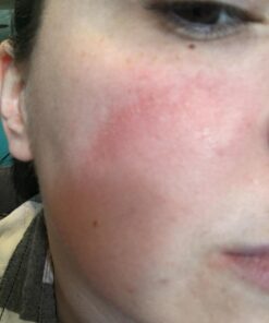 Hydrating Face Moisturizer & Body Cream with Manuka Honey Cream - Organic Face Moisturizer & Body Lotion for Extremely Dry Skin - For Dry & Itchy Skin, Rosacea & Eczema Prone Skin (Original, 2oz) Original 2 Ounce (Pack of 1) 41 71utfqmgr5L 1