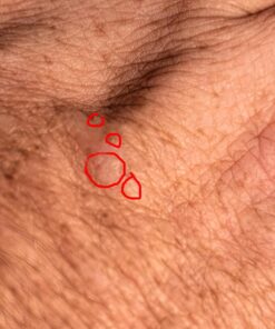 Silver Miracles Colloidal Silver Gel - Nano Silver Gel Wound Care - Healing Ointment for Burns, Sunburns & Irritated Skin - 4 Oz Unscented 32 71vPJyOhcL