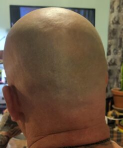 Head Shaver for Bald Men,5 in 1 Bald Head Shavers for Men Cordless,Waterproof Wet/Dry 5 Head Mens Electric Razor for Head Face Shaving, USB Mans Grooming Kit Rechargeable,Rotary Shaver Gift for Men 30 71vjtc0 imL