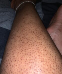 PURELY NORTHWEST-Natural Tea Tree & Peppermint Body Wash for Men & Women-Refreshing Daily Soap for Body Odor & Hygiene, Acne-Effectively Soothes Jock Itch, Chafing & Athletes Foot-Discolored Nails-9oz 9 Fl Oz (Pack of 1) 50 71vuguxSJEL