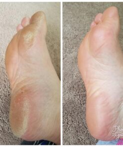 Microplane Colossal Foot File Scraper - The Original Stainless Steel Foot Rasp, Dead Skin/Callus Remover for Feet, Gentle Foot Scrubber, Pedicure Tools for Salon-Quality Foot Care, Black 73 71w xBmNz5L