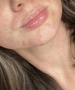 DIM Supplement 200 mg | Estrogen Hormone Balance for Women & Men | Hormonal Acne Supplements, Menopause Support, Antioxidant Support | Clean Label Project Certified, Vegan, Soy Free | 60 Ct. DIM 200mg 67 71wapGxTQzL 1