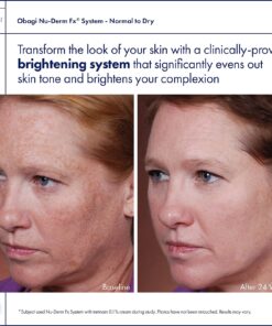 Obagi Medical Nu-Derm System - Normal to Dry Bundle Including: Gentle Clearance, Toner, Clear, Exfoderm, Blend, Hydrate, and Sun Shield, Pack Of 1 19 71wdgOdM7ML