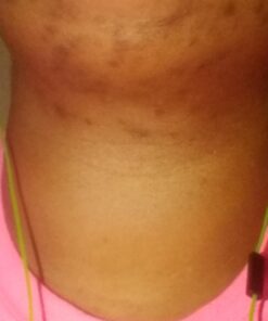 African Black Soap Paste 8 oz. 100% Raw Pure Natural From Ghana. Acne Treatment, Aids Against Eczema & Psoriasis, Dry Skin, Scars and Dark Spots. Great For Pimples, Blackhead, Face & Body Wash. Unscented 8 Ounce (Pack of 1) 66 71wl6AHBRL