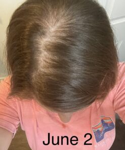 Sugarbear Hair Vitamins Extra Strength Biotin 6000mcg, Vitamin C, E, Coconut Oil, Zinc, Folic Acid, Inositol - Vegan Gummies for Luscious Hair and Nails - Supplement for Women & Men (1 Month Supply) 60 Count (Pack of 1) 37 71wosXDD9sL