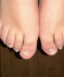 Kerasal Nail Renewal, Restores Appearance of Discolored or Damaged Nails, 0.33 fl oz (Packaging May Vary) 32 71wp5E8umXL