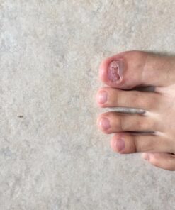 PURELY NORTHWEST-Natural Tea Tree & Peppermint Body Wash for Men & Women-Refreshing Daily Soap for Body Odor & Hygiene, Acne-Effectively Soothes Jock Itch, Chafing & Athletes Foot-Discolored Nails-9oz 9 Fl Oz (Pack of 1) 43 71wqd iMU3L