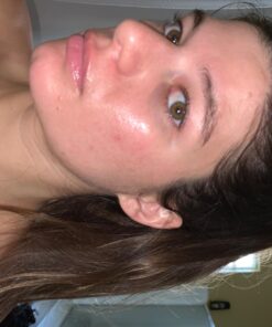 TruSkin Tea Tree Clear Skin Super Serum, Formulated with Tea Tree Oil, Vitamin C, Salicylic Acid, Niacinamide & Retinol, 1fl oz 1 Fl Oz (Pack of 1) 57 71x4 EfiH4L 3