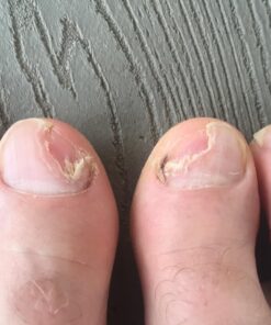 Radha Beauty Tea Tree 120ml - Essential Oil with Natural Premium Melaleuca with Soaps, Shampoo, Body Wash, Aromatherapy and Antifungal Treatment 4 Fl Oz (Pack of 1) 50 71x7GwW7 FL