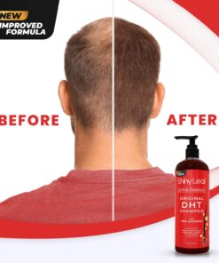 DHT Blocker Shampoo and Conditioner for Hair Loss With Biotin For Men, Women, Anti-Hair Loss Treatment, Rosemary Leaf Oil and Asparagus Extracts, for Thinning Hair (Shampoo and Conditioner) 16 Fl Oz (Pack of 2) 26 71xuubJHkL