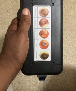 【Lifetime Warranty】4th Generation Doctor Mom LED Pocket Pro Otoscope with both Adult and Pediatric Disposable Specula Tips, Battery, and Protective Hard Plastic Case 25 71xza5nIKwL