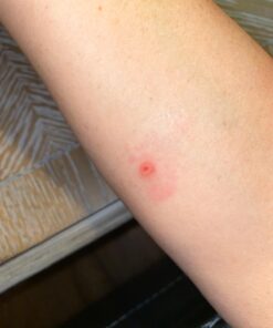 Dr. Scholl's Clear Away WART Remover HYDROGEL Bandage // 12 Discs/9 Cushions, Clinically Proven, Immediate & All-Day Cushioning Pain Relief, Multi-Day Coverage, 12 Treatments 35 71yEYQi3TL