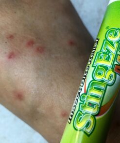 StingEze MAX Bug Bite Relief, Maximum Itch Relief from Bug Bites and Stings, Stops Pain, Relieves Itching, Reduces Infection - 0.5 oz Travel Pen Dauber 30 71yI0HpivlL