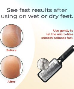 Microplane Colossal Foot File Scraper - The Original Stainless Steel Foot Rasp, Dead Skin/Callus Remover for Feet, Gentle Foot Scrubber, Pedicure Tools for Salon-Quality Foot Care, Black 47 71yUX5k9gPL