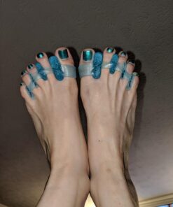 DR. JK- ToePal Gel Toe Separator, Narrow, 1 Pair, Toe Spacers, Toe Straightener, Hammer Toe Straightener, Toe Spreader, Toe Stretcher, Toe Corrector for Women and Men, Bunion Corrector 13 71yqSLsT0L