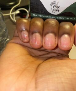 Toenail Fungus Treatment Extra Strength with 25% Undecylenic Acid - Fungal Nail Treatment for Toe Nail & Fingernails - Antifungal Nail Repair Solution for Discoloured & Ingrown Nails – Made in USA 0.5 Fl Oz (Pack of 1) 51 71yxkx5oSML 3