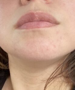 Sports Research Evening Primrose Supplement from Cold Pressed Oil - Softgels for Women’s Health & Skin Health - Gluten Free & Non-GMO GLA - High Potency 1300mg, 120 Count 120 Count (Pack of 1) 42 71zU38aXW L 2