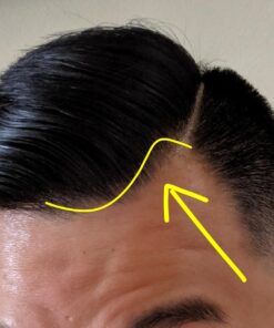 Hairgenics Pronexa Clinical Strength Hair Growth & Regrowth Therapy Hair Loss Shampoo With Biotin, Collagen, and DHT Blockers for Thinning Hair, 8 fl. oz. 47 71zhHmmbQML 1