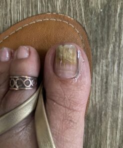 Kerasal Nail Renewal, Restores Appearance of Discolored or Damaged Nails, 0.33 fl oz (Packaging May Vary) 42 71zsBSVJ49L