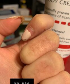 Eucerin Eczema Relief Cream, Full Body Lotion for Eczema-Prone Skin, Moisturizing Eczema Cream, Body Moisturizer, 8 oz. Tube 46 81 y2psf7L