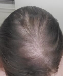 PURA D'OR Professional Grade Biotin Anti-Hair Thinning Shampoo & Conditioner, CLINICALLY TESTED Proven Results, 2X Concentrated DHT Blocker Thickening Products For Women & Men, Sulfate Free, 16oz x 2 32 8111fxSMeXL 2