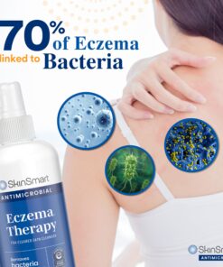 SkinSmart Antimicrobial Eczema Therapy with Hypochlorous Acid, Removes Bacteria so Skin Can Heal, for Adults, Kids and Seniors, 8 Ounce Clear Spray 8 Fl Oz (Pack of 1) 27 8122KGkY XL