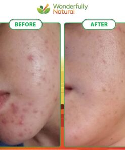 Organic African Black Soap - For Acne & Dark Spots | Natural Vegan and Cruelty Free – Satisfaction Guarantee 1lb bar | 90 day Supply 1 Pound (Pack of 1) 35 8123X ZTF3L 1