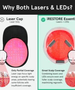 iRestore Essential Laser Hair Growth System - FDA Cleared Hair Loss Treatments for Men & Women & Hair Growth Products for Men with Thinning Hair, Hair Regrowth Treatments Laser Cap, Red Light Therapy 31 812CsYMWeL 1