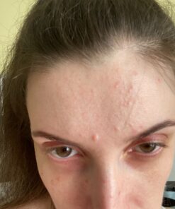 Mario Badescu Drying Lotion, 1 Fl oz 01 Drying Lotion Glass Bottle, 1 Fl oz 35 812oo2CVprL