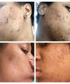 Organic African Black Soap - For Acne & Dark Spots | Natural Vegan and Cruelty Free – Satisfaction Guarantee 1lb bar | 90 day Supply 1 Pound (Pack of 1) 51 813G1Fq0nOL