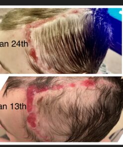 Dr. Nordyke's Wound Honey New Zealand Manuka Honey for Infections,Burns,Cuts and Scars (80g) 2.8 Ounce (Pack of 1) 28 814gv1Fq0JL