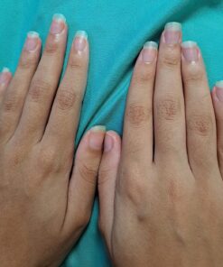 Nutra Nail 5 to 7 Day Growth Treatment - Fast Keratin Nail Hardener & Nail Strengthener for Thin Nails, Brittle & Damaged (0.47 Fl Oz) 0.50 Fl Oz (Pack of 1) 36 815tFIC2ZwL 1