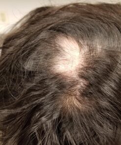 DrFormulas HairOmega 3-in-1 Hair Growth Vitamins with DHT Blocker, Biotin for Women & Men | Hair Skin and Nails Supplement for Hair Loss, 120 Pills 120 Count (Pack of 1) 47 818IugG5SJL