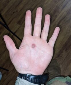 Compound W Nitrofreeze | Wart Removal | 1 Pen & 5 Replaceable Tips 67 81CCh0Nl59L 2