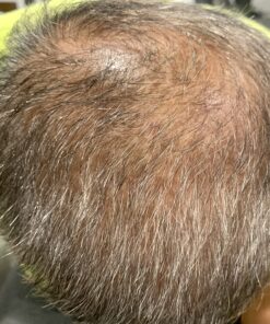 PURA D'OR Deep Moisturizing Biotin Conditioner (16oz) Thickens, Softens, & Moisturizes Dry, Frizzy, Damaged Hair w/Argan Oil, Pumpkin, Rosemary, Honeysuckle, Vitamin E, Men Women (Packaging may vary) 16 Fl Oz (Pack of 1) 37 81ChdY99N2L