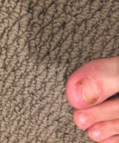 3 in 1 Professional Foot Spa Kit-with Tea Tree Foot & Body Soak-Tea Tree Body Wash & Nail Blend-Soothes Dry, Burning & Itchy Skin-Refreshes Unwanted Foot Odor-Restores Unhealthy Nails-Purely Northwest Tea Tree Oil 3 Piece Set 43 81Dlaz0M4EL 1