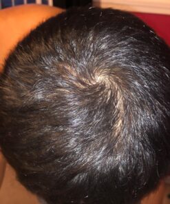 Hairgenics Propidren Hair Growth Shampoo for Thinning and Balding Hair with Biotin , Keratin, and Powerful DHT Blockers to Prevent Hair Loss, Nourish and Stimulate Hair Follicles and Help Regrow Hair. 26 81FWC8KpbtL