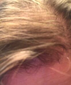 Hairgenics Pronexa Clinical Strength Hair Growth & Regrowth Therapy Hair Loss Shampoo With Biotin, Collagen, and DHT Blockers for Thinning Hair, 8 fl. oz. 38 81FmH6lBqrL