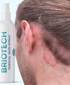 BRIOTECH Hypochlorous Acid Spray, Topical Skin Face & Body Mist, Support Irritations, Soothe Redness, Dry Skin & Scalp, Athletic Itch, Packaging May Vary 3.4 Fl Oz (Pack of 1) 32 81GNAXQBPjL