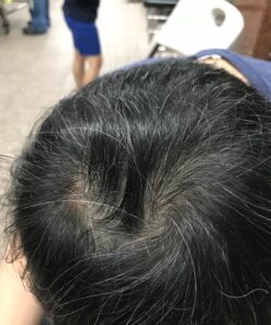 artnaturals Moroccan Argan Oil Hair Loss Shampoo & Conditioner Set - (2 x 16 Fl Oz / 473ml) - Sulfate Free Hair Regrowth - Treatment for Hair Loss, Thinning Hair & Hair Growth, Men & Women 16 Fl Oz (Pack of 2) 29 81Hldp1bROL