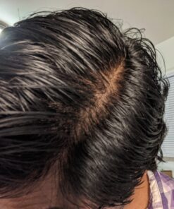 Saw Palmetto & Cayenne Scalp Oil For Hair Growth, Hair Loss Serum, Hair Oil For Dry Damaged Hair And Growth, Hair Growth Serum For Thicker Longer Fuller Healthier Hair, All Natural Vitamin Rich 34 81Hrvdkp6mL