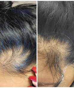 Sports Research Vegan Biotin 10,000mcg with Coconut Oil - Max Strength Biotin Vitamin B7 for Skin and Keratin Support - Non-GMO & Gluten Free, 120 Softgels (4 Month Supply) 120 Count (Pack of 1) 52 81Ih1KnFnL